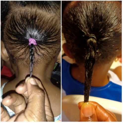 Sheesa The Best Kit To Grow Your Baby's Hair