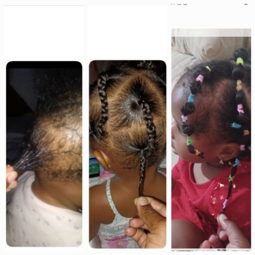 Sheesa The Best Kit To Grow Your Baby's Hair